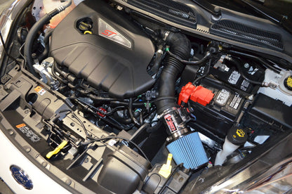 Injen Short Ram Intake | Ford Fiesta ST (08-19) 1.6L Turbo (SP9018P)