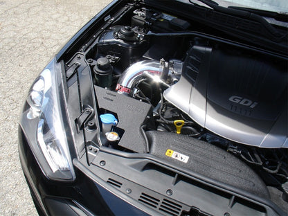 Injen Black Short Ram Intake | Genesis Coupe 3.8 (13-16) (SP1392BLK)