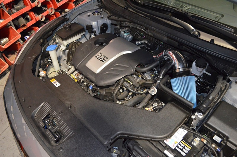 Injen Black Short Ram Intake | Hyundai Sonata (15-18) / Kia Optima / Hyundai Azera (12-17) / Kia Optima (16-20) (SP1332BLK)